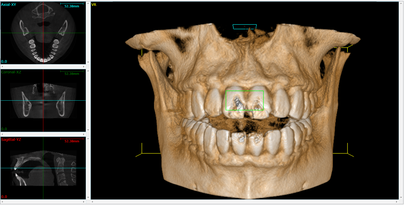 Cone Beam 3D Imaging  Leesburg, FL 