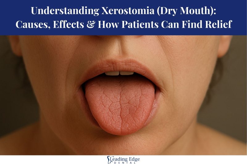 Understanding Xerostomia (Dry Mouth) Causes, Effects & How Patients Can Find Relief