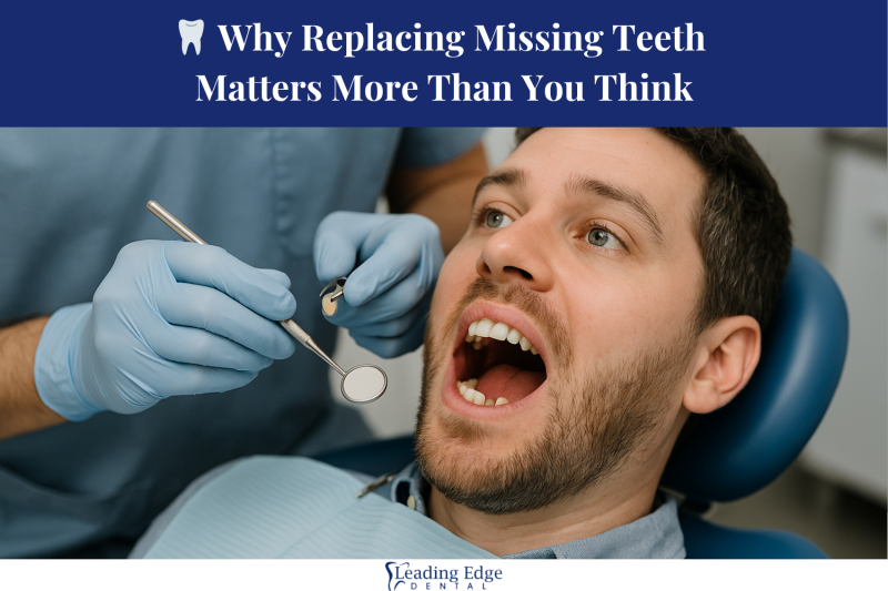 🦷 Why Replacing Missing Teeth Matters More Than You Think